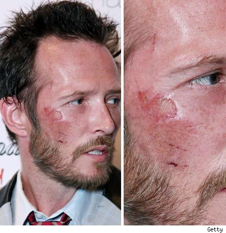 Scott Weiland -- Marsha Brady'd at Notre Dame