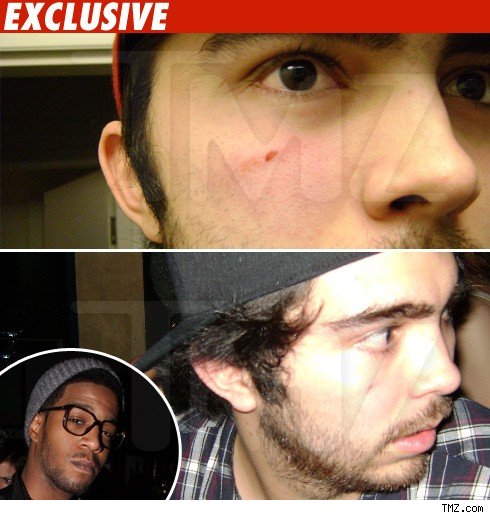 Kid Cudi's Alleged Victim -- No Hard Feelings