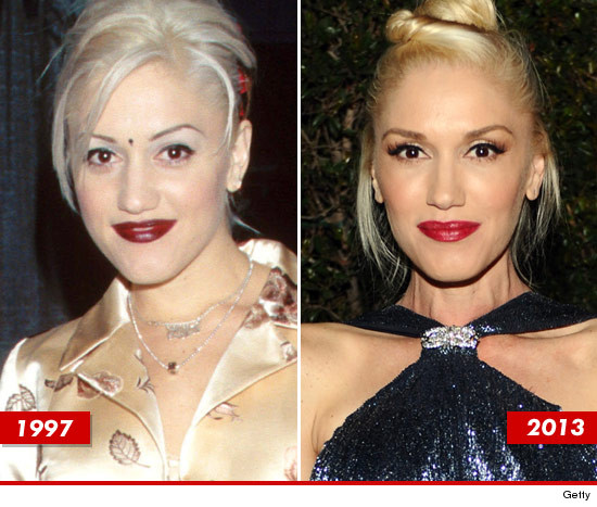 Gwen Stefani Good Genes Or Good Docs