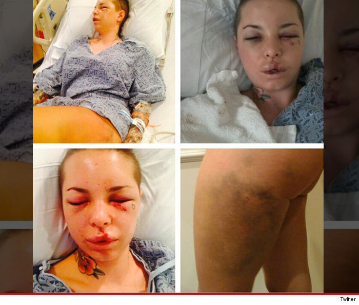 Christy Mack War Machine Almost Killed Me Broken Bones.