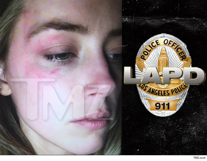 Amber Heard: Cops Say No Evidence of Injuries Amber Heard: Cops Say No Evidence of Injuries