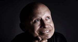 Verne Troyer Dead at 49
