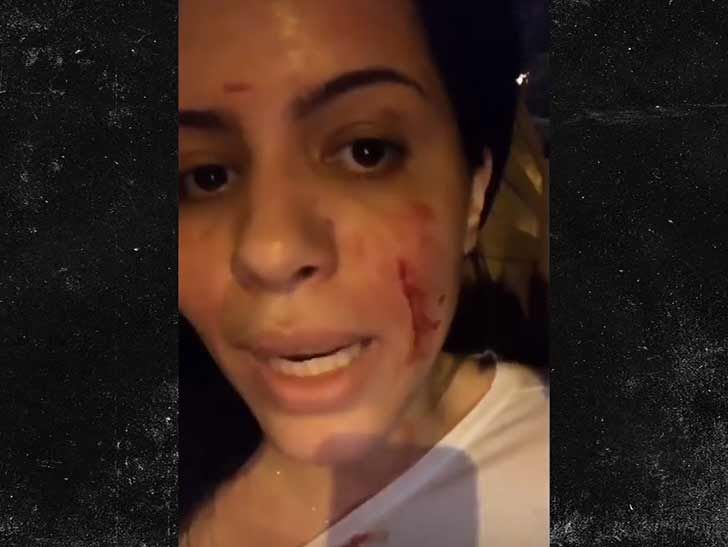 '90 Day Fiance' Stars Larissa and Colt Get in Bloody Fight Over Porn, Cops Called