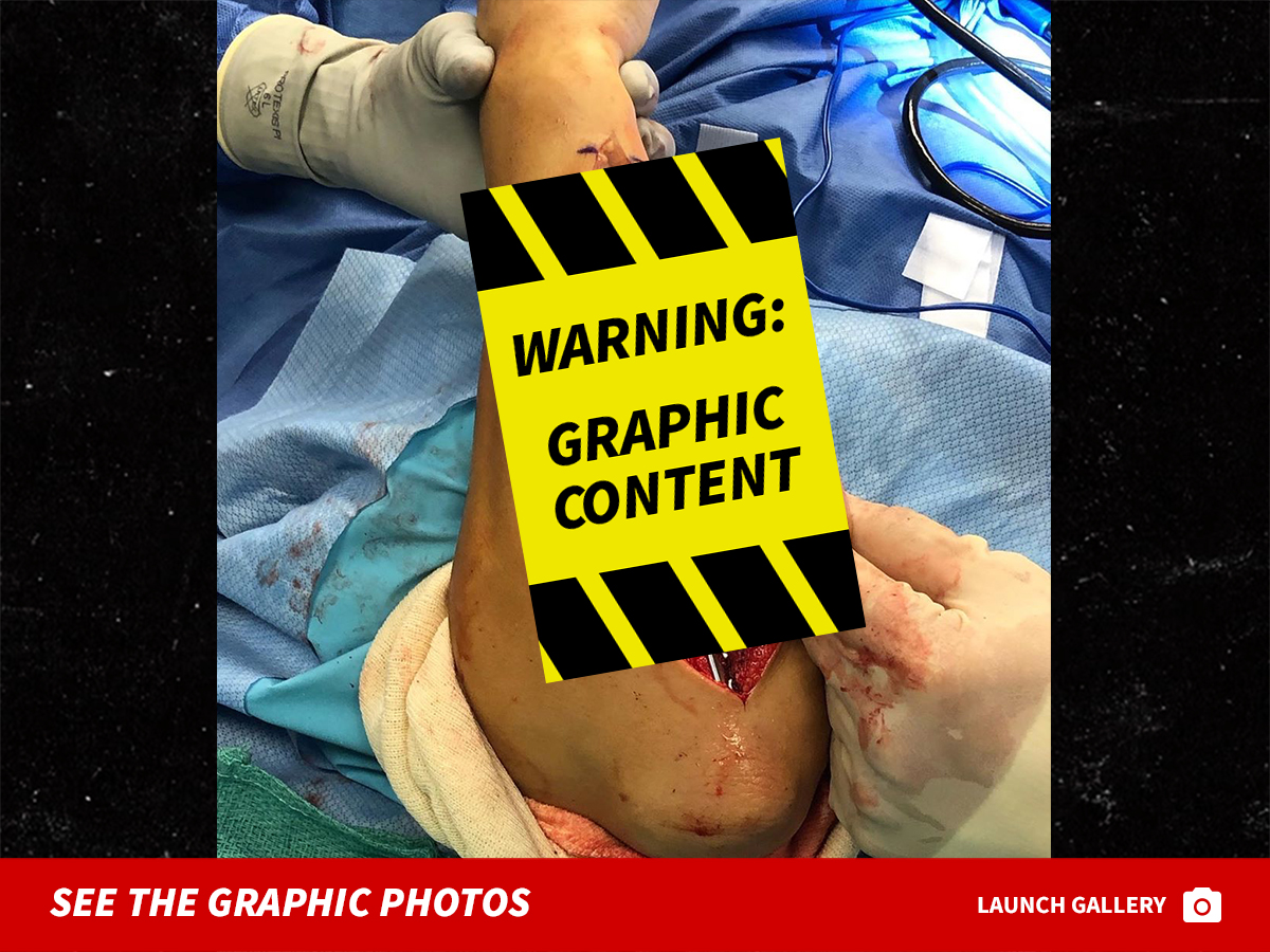 UFC's Paige VanZant Shows Bloody, Graphic Surgery Pics For ...